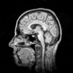 ExtractRidgesOriginal